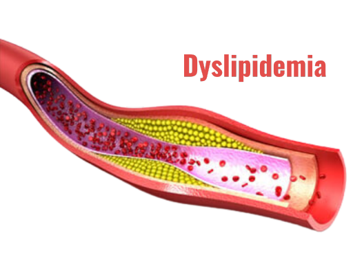 Dyslipidemia Management