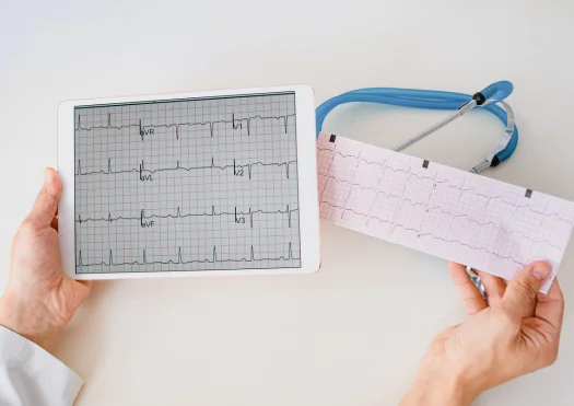 Arrhythmia Management