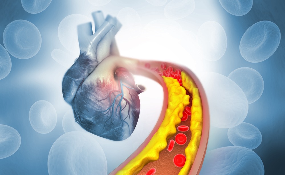 Illustration of an irregular, racing heartbeat